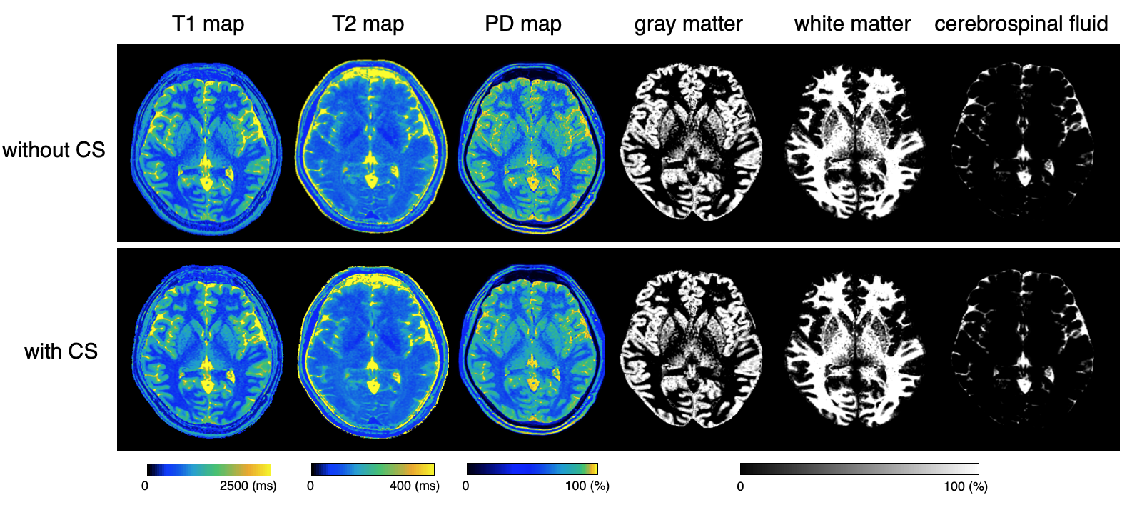 Isotropic 1 mm multi-parametric imaging of the whole brain based on 3D ...