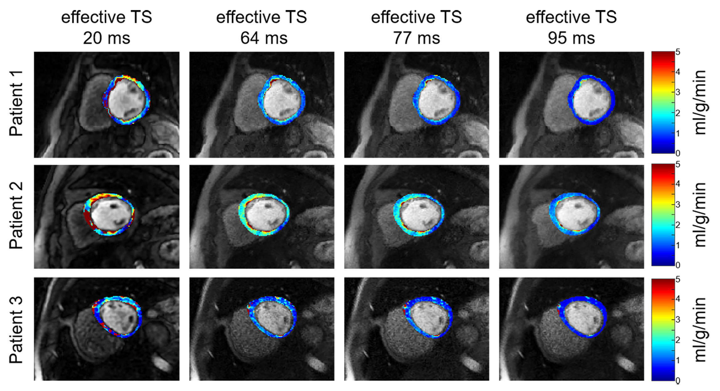 Figure 3 representative mbf mapsoverlaid on images of 3 different