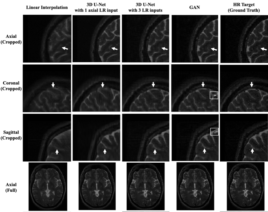 Figure 1. The top three rows are the cropped MRI patchesin the ...